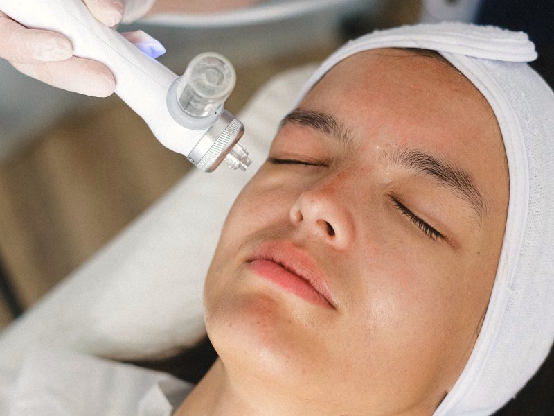 Esteticista aplicando ponteira de peeling de diamante no rosto da paciente