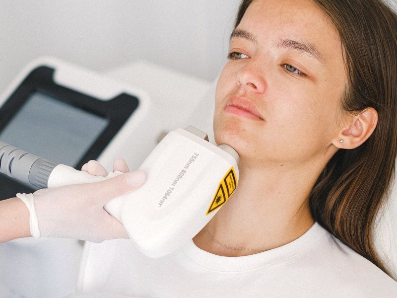 Aplicação de ultrassom HIFU na região do queixo e da papada